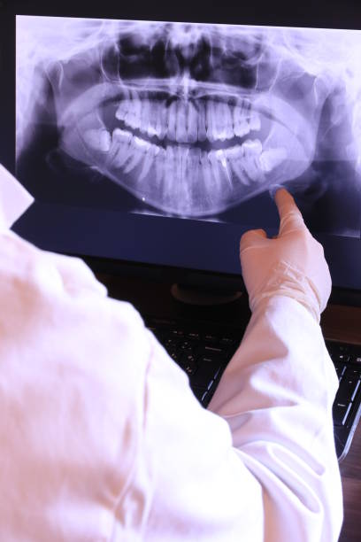 Best Broken or Cracked Tooth Emergency Dentist in Astor, FL